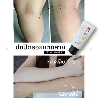 ปกปิดรอยแตกลายและปรับสีผิวSHIZENBI