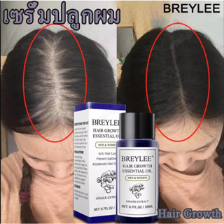 BREYLEE ผลิตภัณฑ์ดูแลเส้นผม น้ำมันหอมระเหยปลูกผม สารสกัดจากขิง ดูแลเส้นผมอย่างมีประสิทธิภาพ ป้องกันศีรษะล้าน ผมร่วง 20 ม