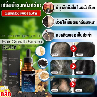 🧧 เซรั่มบำรุงหนังศรีษะปลูกเส้นผมใหม่ Bunee hair growth Serum