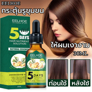 EELHOEน้ำยาขิงปลูกผม 30mlเร่งผมขึ้นใหม่ รักษาผม ลดผมร่วง น้ำยาเร่งผมยาว เร่งผมยาว น้ำยาปลูกผม เซรั่มปลูกผม ป้องกันผมร่วง