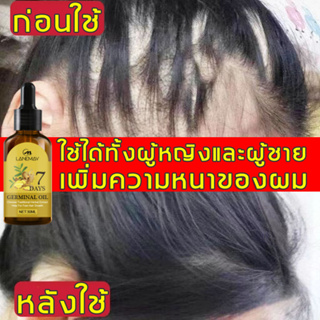 มีสินค้า LANEMAY น้ำยาเร่งผมยาว30mlสเปรย์ปลูกผม เซรั่มปลูกผม น้ำยาปลูกผม บอกลาหัวล้าน ป้องกันผมร่วง บำ​รุง​ศีรษะ บำรุงผม