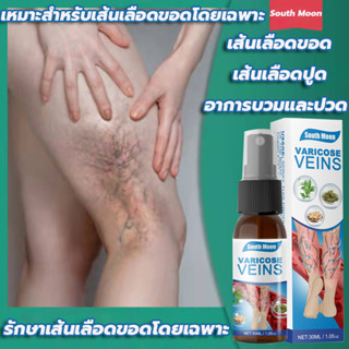 Varicose veins30mlแมงมุมเส้นเลือดปวด ทาเส้นเลือดขอด ครีมทาเส้นเลือดขอด ครีมเส้นเลือดขอด ครีมทาเส้นขอด สเปรย์เส้นเลือดขอด