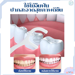 ไหมขัดฟัน ไหมขัดฟันชนิดด้าม ไม้จิ้มฟันพลาสติก 50ชิ้น/กล่อง ไหมขัดฟันแบบแท่ง ไหมขัดฟันแบบด้าม เพื่อขจัดสิ่งตกค้าง