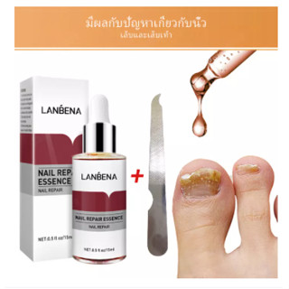 ของแท้ 100% LANBENA เซรั่มบำรุงเล็บ น้ำยาบำรุงเล็บ 15ml บำรุงเล็บ ต่อต้านการติตเชื้อรา ซ่อมแซมเล็บแตก เล็บเปราะ เล็บหนา