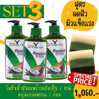 **ราคาพิเศษ+ส่งฟรี** โลชั่นบำรุงผิวจากน้ำมันมะพร้าว สูตรลับ!!ธรรมชาติ✨เซตลดสิวผิวแข็งแรง