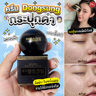 Dongsung Rannce Cream 10 g ครีมลดรอยกระ ฝ้า จุดด่างดำ