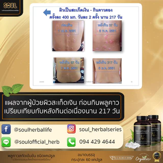 (1 กระปุก) ส่งด่วน ของแท้ อาหารเสริมพลูคาว ลดอักเสบ ไอ ผื่น คัน ภูมิแพ้ ผิวหนัง โซลพลูคาวเบต้ากลูแคน