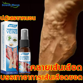 สเปรย์เส้นเลือดขอด30ml แมงมุมเส้นเลือดปวด ทาเส้นเลือดขอด ครีมทาเส้นเลือดขอด ครีมเส้นเลือดขอด ครีมทาเส้นขอดVaricose veins