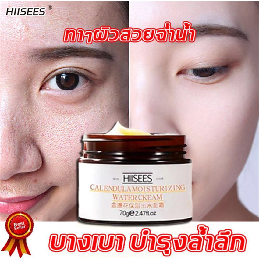 Hiisees ลดริ้วรอย ไวท์เทนนิ่ง เพิ่มความชุ่มชื้น ปรับปรุงผิวแพ้ง่าย และความไม่สมดุลผิวหน้า ครีมบำรุงห