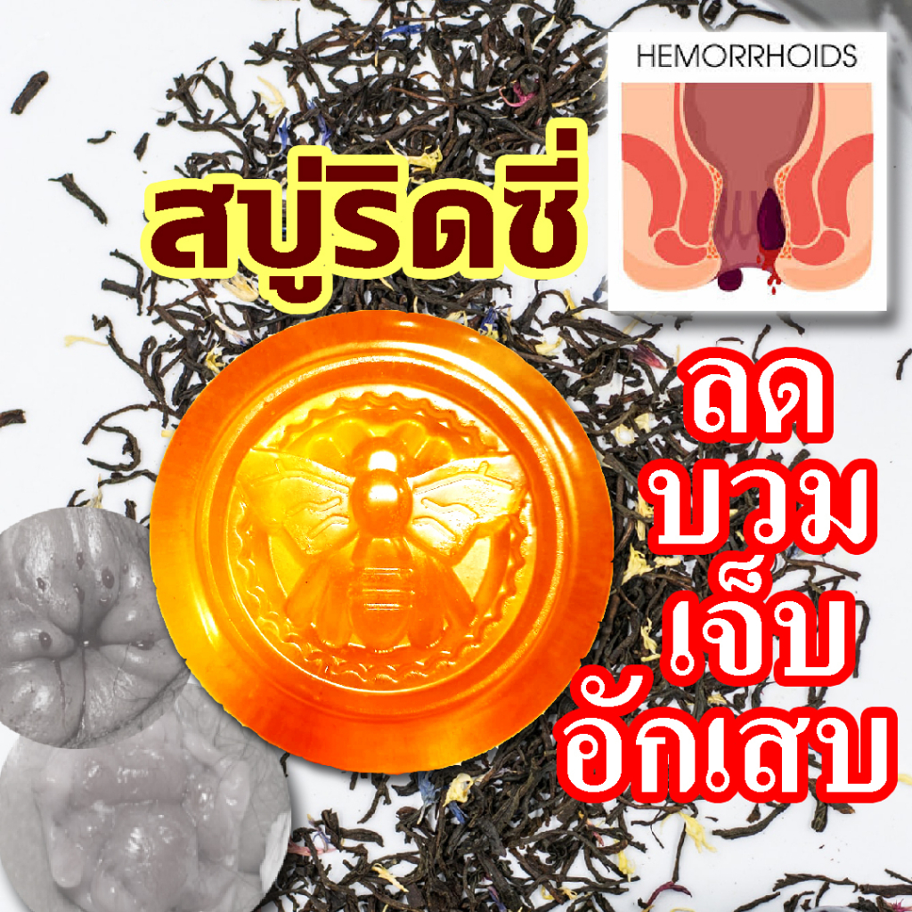 สบู่ฟอกริดสีดวงโดยเฉพาะใช้ลดขนาดเม็ดติ่งหัวที่ยื่นออกมาให้หดยุบลงฟอกทำความสะอาดฆ่าเชื้อแบคทีเรีย