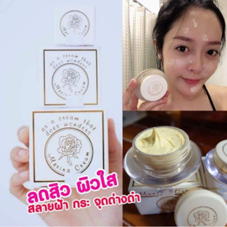 ครีมเเก้มบุ๋ม Merina Cream ครีมเมอร์ริน่า(ครีมในตำนาน 30 ปี) สูตรอ่อนโยน รับประกันของเเท้100%