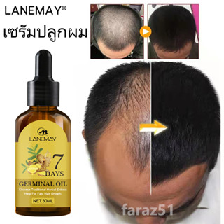 LANEMAY เซรั่มปลูกผม ปลูกผม บํารุงผม ป้องกันผมร่วง ผมบาง ศีรษะล้าน 30ml น้ํายาเร่งผมยาว เซรั่มบํารุงผม เซรั่มผม