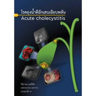 [ศูนย์หนังสือจุฬาฯ]9786165885508โรคถุงน้ำดีอักเสบเฉียบพลัน (ACUTE CHOLECYSTITIS) c111