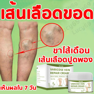 ครีมทาเส้นเลือดขอด เส้นเลือดขอด ของแทั ยาทาเส้นเลือดขอด ส่งเสริมการไหลเวียนโลหิต ลดอาการปวด ลดอาการบวม 50g