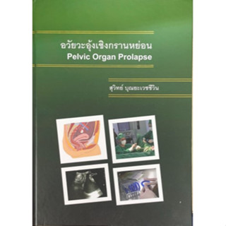 [ศูนย๋หนังสือจุฬาฯ] 9786165939546 ภาวะอวัยวะอุ้งเชิงกรานหย่อน (PELVIC ORGAN PROLAPSE) C111