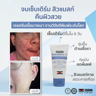 ISDIN Nutradeica® DS Facial Gel Cream เจลครีม ดูแลผิวเซ็บเดิร์มและสิวจากการ ใส่ mask ผิวชุ่มชื้น ปรับสมดุลผิว ลดอาการคัน