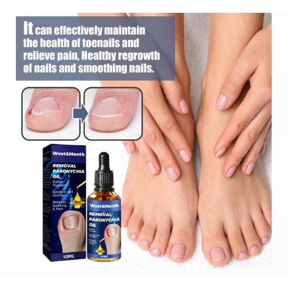 น้ำมันฆ่าเชื้อราที่เล็บลดปวดบวมอักเสบ Removal paronychia oil - รูปที่ 5