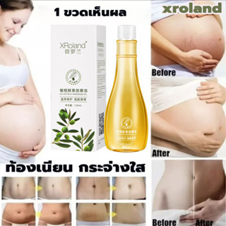 XRoland ครีมลดรอยแตก 150g ขาแตกลาย ลดรอยแตกลาย ครีมทาท้องลาย ครีมลดรอยแตกลาย แก้ท้องลาย กระชับผิวให้เรียบเนียน