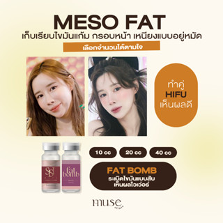 [E-Voucher] MUSE CLINIC : Meso Fat 20cc. ทั้งหน้าและเหนียง