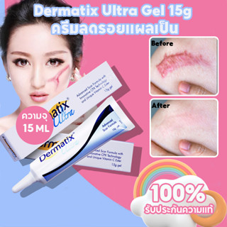 เดอร์มาติกซ์ Dermatix Ultra Gel 15g Acne Scar ครีมลดรอยแผลเป็น ลดรอยแผลเป็น ครีมรักษาแผลเป็น