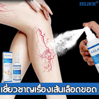 Eelhoe สเปรย์บรรเทาอาการปวดขา 30ml เชี่ยวชาญเรื่องเส้นเลือดขอด ปรับปรุงขาไส้เดือนบวมและความรุนแรง