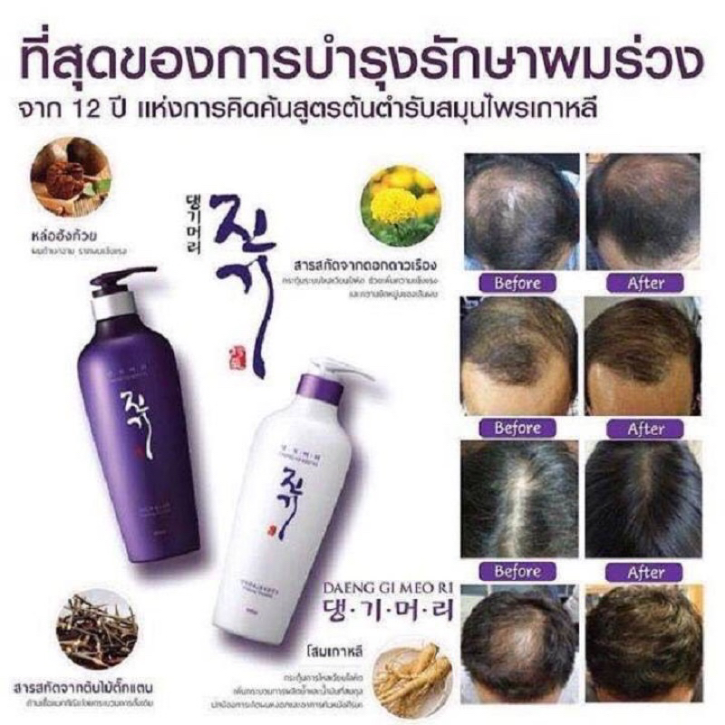 แท้/ส่งไวมาก🎁 Daeng gi meo ri DLAESOO Anti-Hair Loss shampoo 400ml แชมพูสมุนไพร แชมพูเกาหลี ลดผมร่วง - รูปที่ 4