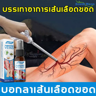 Varicose veinsสเปรย์เส้นเลือดขอด30ml ทาเส้นเลือดขอด ครีมทาเส้นเลือดขอด ครีมเส้นเลือดขอด ครีมทาเส้นขอด แมงมุมเส้นเลือดปวด