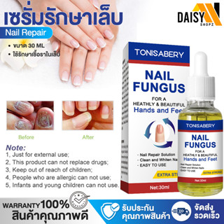 ฆ่าเชื้อราที่เล็บ เซรั่มรักษาเล็บ Nail Fungus เชื้อราเล็บ 30ml ครีมบำรุงเล็บ น้ำยารักษาเชื้อรา ยาฆ่าเชื้อราเล็บ