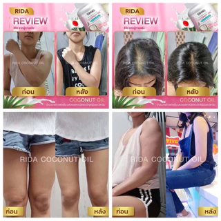 Rida ริด้า Coconut Oil นํ้ามันมะพร้าวสกัดเย็น คอลลาเจนไดเปปไทด์ญี่ปุ่นและวิตามิน คุมหิว อิ่มนาน น้ำหนักลด ขับถ่ายง่าย
