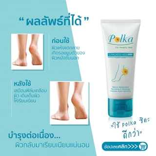 Polka Cracked Heel Cream พอลก้า แคร๊ก ฮีล ครีม 60 กรัม (2 หลอด) ครีมทาส้นเท้าแตก GG 8303