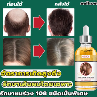 ผมยาวเร็วกว่าการปลูกผม💨 เซรั่มปลูกผม 30ml นำ้ยาใส่ผมขึ้น สเปรย์ปลูกผม เชรั่มปลูกผม เร่งผมงอกใหม่ เซรั่มปลูกผมดก