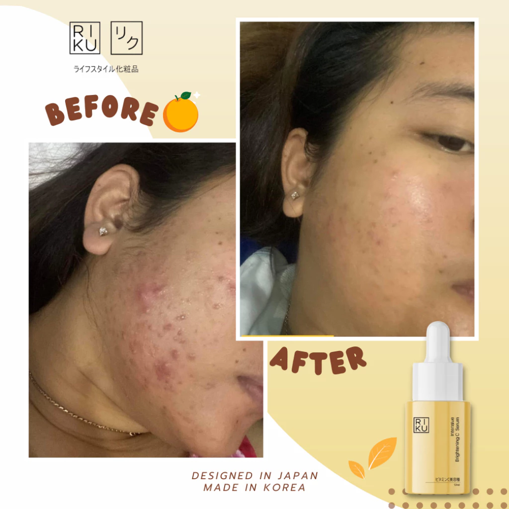 RIKU repair barrier set ริคุบูสเตอร์ข้าว Organic และวิตามินซีเซรั่ม สกินแคร์ Skincare บำรุงผิว thumbnail 7