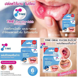 (กล่อง6แผ่น)Time Oral Ulcer Patch  แผ่นปิดแผลในช่องปาก เหมาะสำหรับ แผลร้อนใน แผลจากการกัดหรือกระแทก
