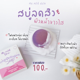 [เก็บโค้ชในไลฟ์สด20.00-00.00ลด50% ] พร้อมส่ง‼️สบู่ ms mild skin 🧼 ลดสิว ผิวแพ้ง่ายใช้ได้ มีเก็บปลายทาง📮