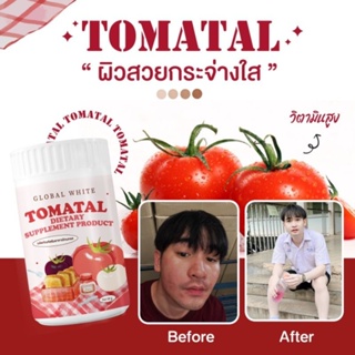 TOMATAL น้ำชงมะเขือเทศ 3 สี🍅