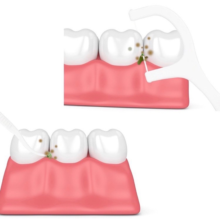 ไหมขัดฟันชนิดด้าม/ไม้จิ้มฟันพลาสติก ไหมขัดฟันชนิดด้าม ไหมขัดฟันแบบแท่ง 1 แพ็คมี 12 กล่อง กล่องละ 30 ชิ้น - รูปที่ 3