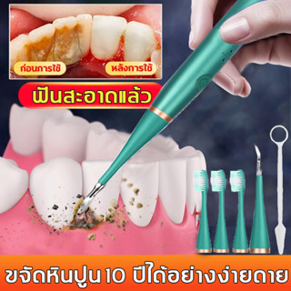 🦷ขจัดหินปูนฟัน 10 🦷ที่ขูดหินปูน ป้องกันฟันผุ ลดกลิ่นปาก ไม่เจ็บเหงือก ออกแบบกันน้ำ เครื่องขูดหินปูน เครื่องขัดฟัน