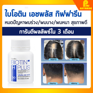 [ส่งฟรี] วิตามินบำรุงผม กิฟฟารีน ไบโอติน บำรุงผม เอช พลัส ผมร่วง ผมบาง แก้ผมร่วม Biotin H plus Giffarine