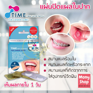 แผ่นแปะร้อนใน TIME ORAL ULCER PATCH ร้อนใน แผ่นแปะร้อนในTIME บรรจุ 6 ชิ้น