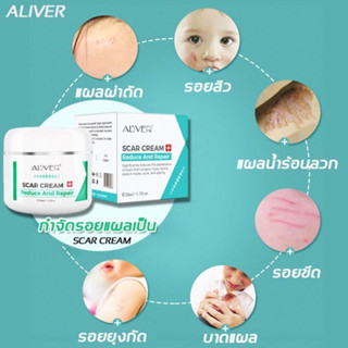 ALIVER Repair Scar Scar Cream Remove Stretch Mark Scald Caesarean Bump Surgery Scar ครีมลดรอยแผลเป็น สูตรสมุนไพร 50ml