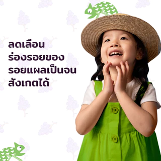 Exp.01/2027 | Mederma Scar Gel for Kids 20g. | เจลทาแผลเป็น สูตรอ่อนโยนสำหรับเด็ก ลดรอยแผลเป็น ปรับสีผิวให้สม่ำเสมอ