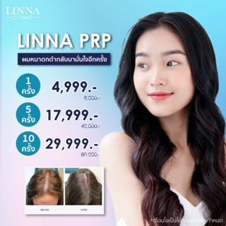 LINNA Vampire Face Lift Platelet Rich Plasma (PRP) 10 ครั้ง