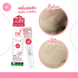 BK Acne Serum เซรั่มลดสิว ลดปัญหาสิวเกิดใหม่ ฟื้นฟู บำรุงผิว เซรั่มปกป้องผิวจากมลภาวะ ขนาดหลอด 35g. (FG0019)