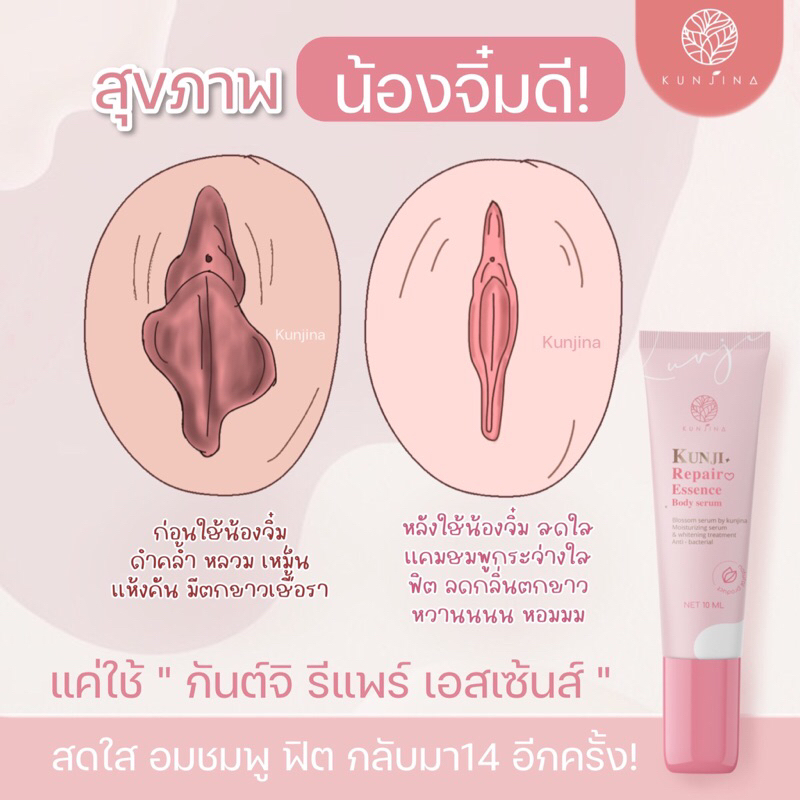 ส่งฟรี!!(ปิดชื่อสินค้า)กันต์จิรีแพร์น้องสาว อมชมพู #Kunji repair essence รีแพร์จิมิฟิส ตอด แฟนติดใจ