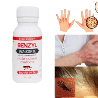 1ขวด 30มล หิด เหา โลน โลชั่น benzyl benzoate25% scabies crab lice public lice treatment