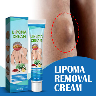 Aday Beauty ครีมกำจัด Lipoma 0.7oz สารสกัดจากพืชแบบพกพา Treatment Care Cream สำหรับบรรเทาอาการไม่สบาย