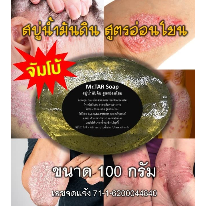 สบู่น้ำมันดิน (MR.TAR Soap)สบู่โรคผิวหนัง สะเก็ดเงิน เซบเดิร์ม ผิวหนังอักเสบ ผื่นคัน  ขนาด 100 กรัม