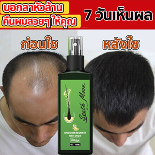 ของแท้100% South Moon ยาปลูกผม น้ำยาปลูกผม บำรุงผม ปลูกผม เซรั่มปลูกผม ป้องกันผมร่วง Hair Growth ​รักษาผม น้ํายาปลุกผม