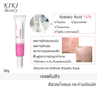 Azelaic acid 15% เจลล้างสิว ทําความสะอาดล้ําลึก แอคเน่เจล สำหรับผิวแพ้ง่าย สิวผด สิวอักเสบ สิวมีหัว ไม่มีหัว เพียวรี