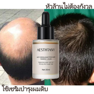 แชมพูขิง แชมพูปลูกผม แชมพูแก้ผมร่วง 30ml ผมร่วงน้อยลง ผมใหม่เติบโตอย่างรวดเร็วความปลอดภัยหนังศีรษะป้องกัน หนังศีรษะ